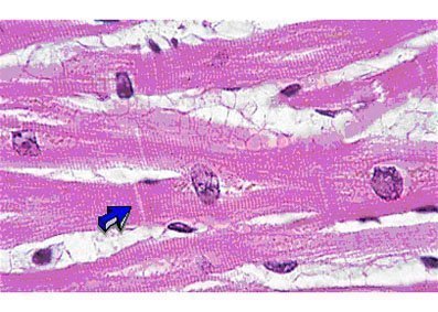 músculo cardíaco músculo cardíaco